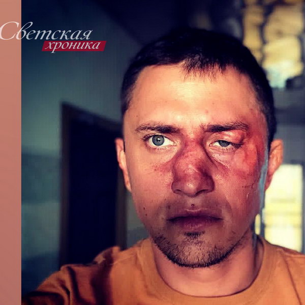 «Светская хроника» расскажет, за что избили Павла Прилучного и от чего умер Диего Марадона